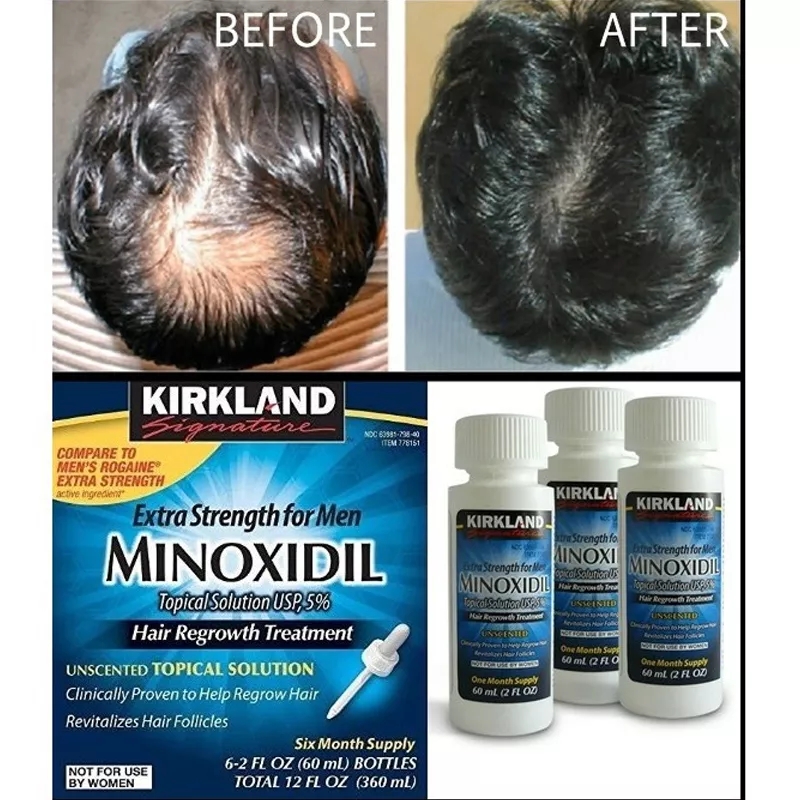 Minoxidil Hair Growth Oil For Men
