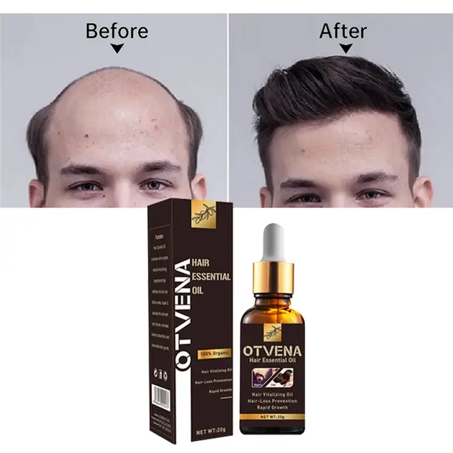 OTVENA hair growth oil