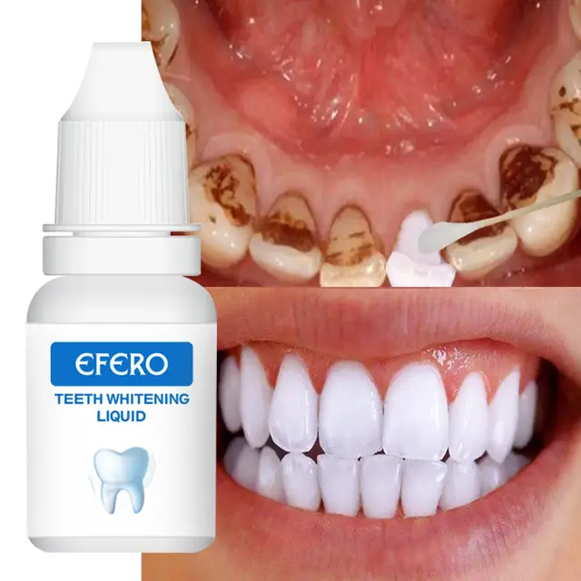 Efero Teeth Whitening Liquid